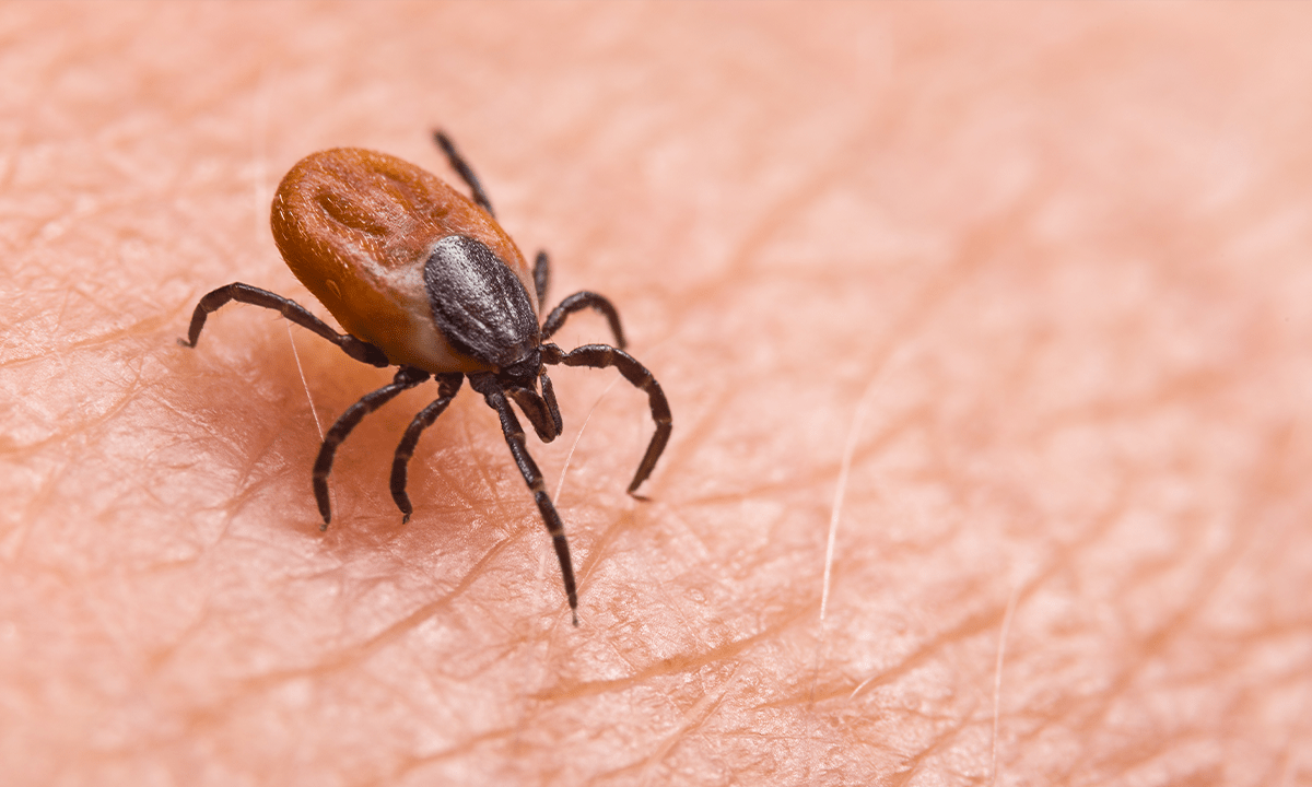 Close-up of a tick on human skin. Credit: KPixMining / Shutterstock.