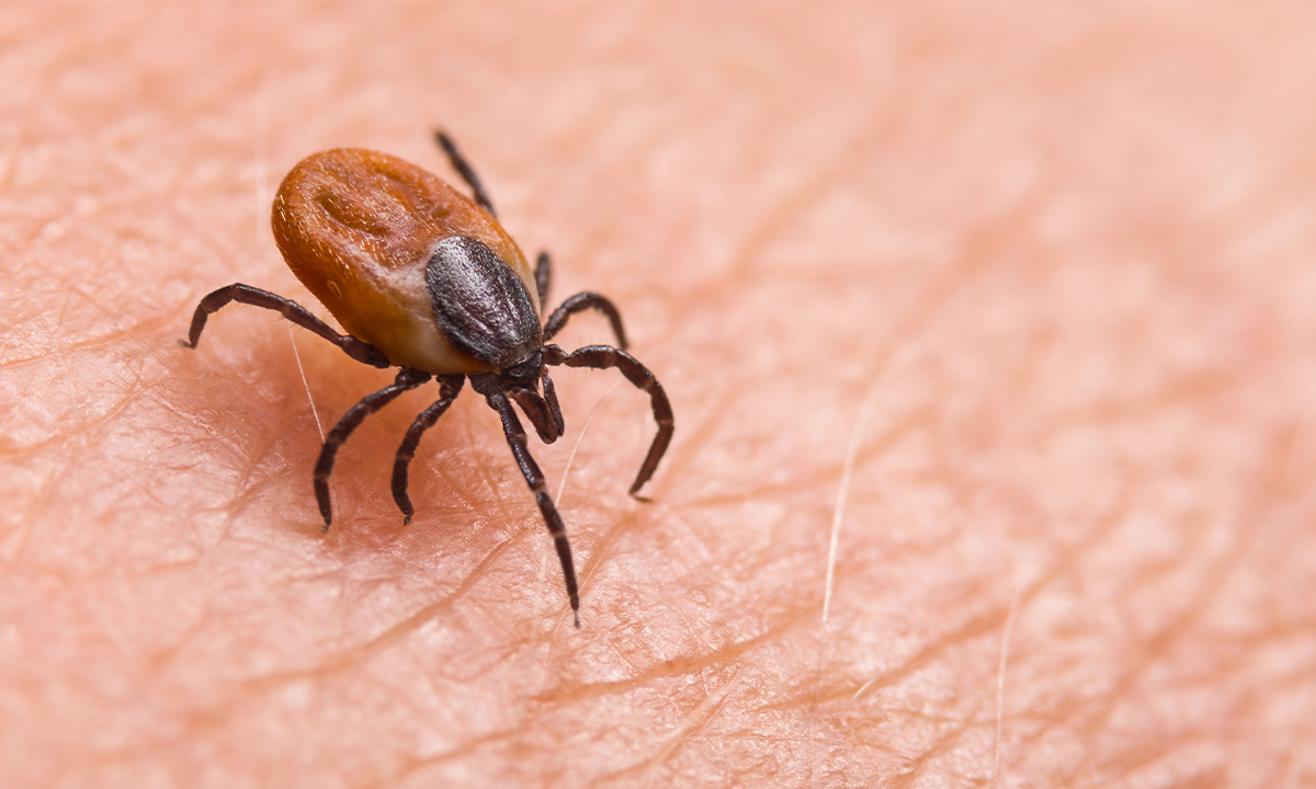Close-up of a tick on human skin. Credit: KPixMining / Shutterstock.