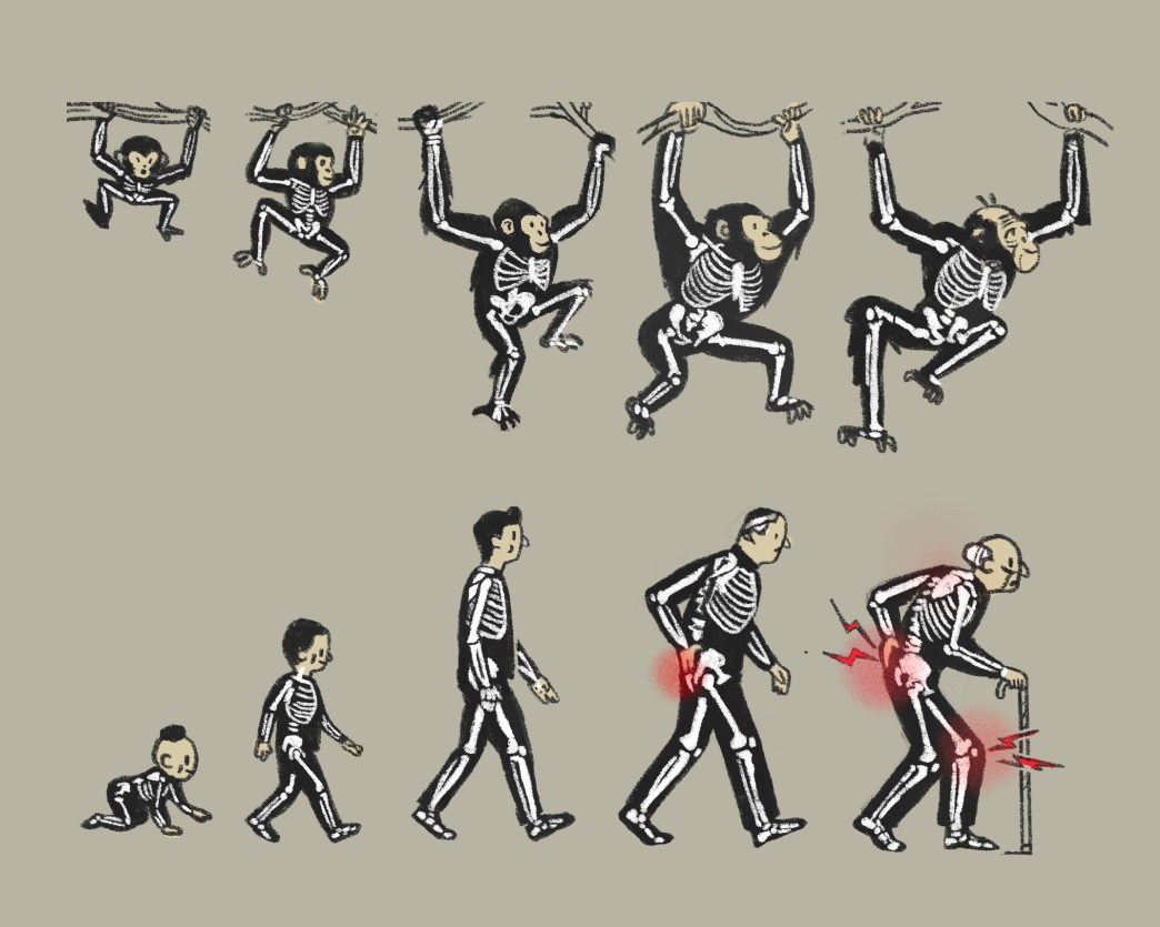 The Evolutionary Raw Deal of the Human Knee