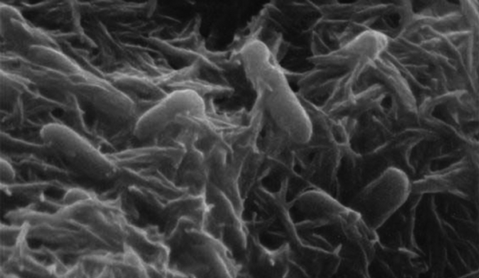 “Zombie Bacteria” Might One Day Lurk in the Sewers