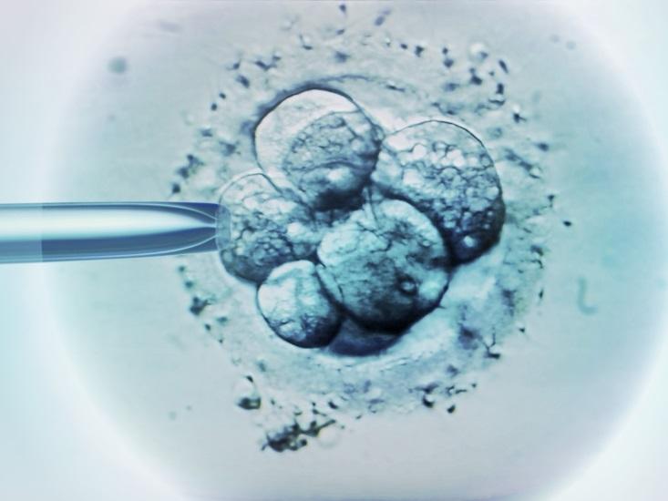 IVF embryo selection